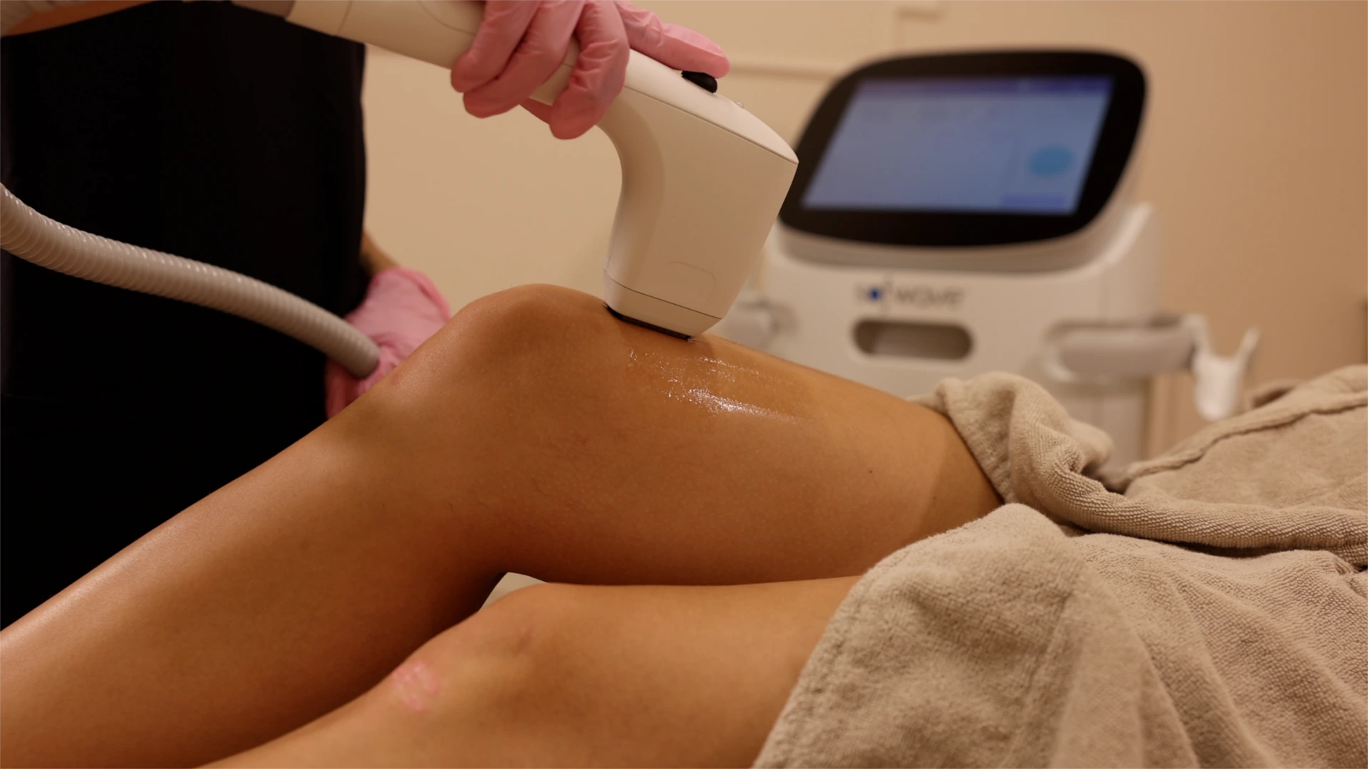 Is Sofwave Painful? What You Should Expect Banner